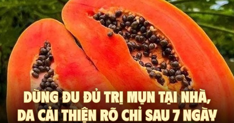 3 cách dùng đu đủ trị mụn tại nhà, da đẹp lên sau 7 ngày