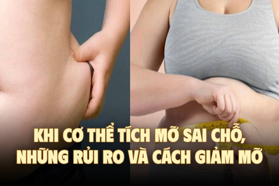 When the body accumulates fat in the wrong place, risks and ways to reduce fat