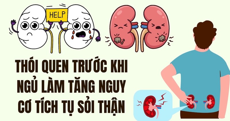 Thói quen đi ngủ muộn làm tăng nguy cơ sỏi thận