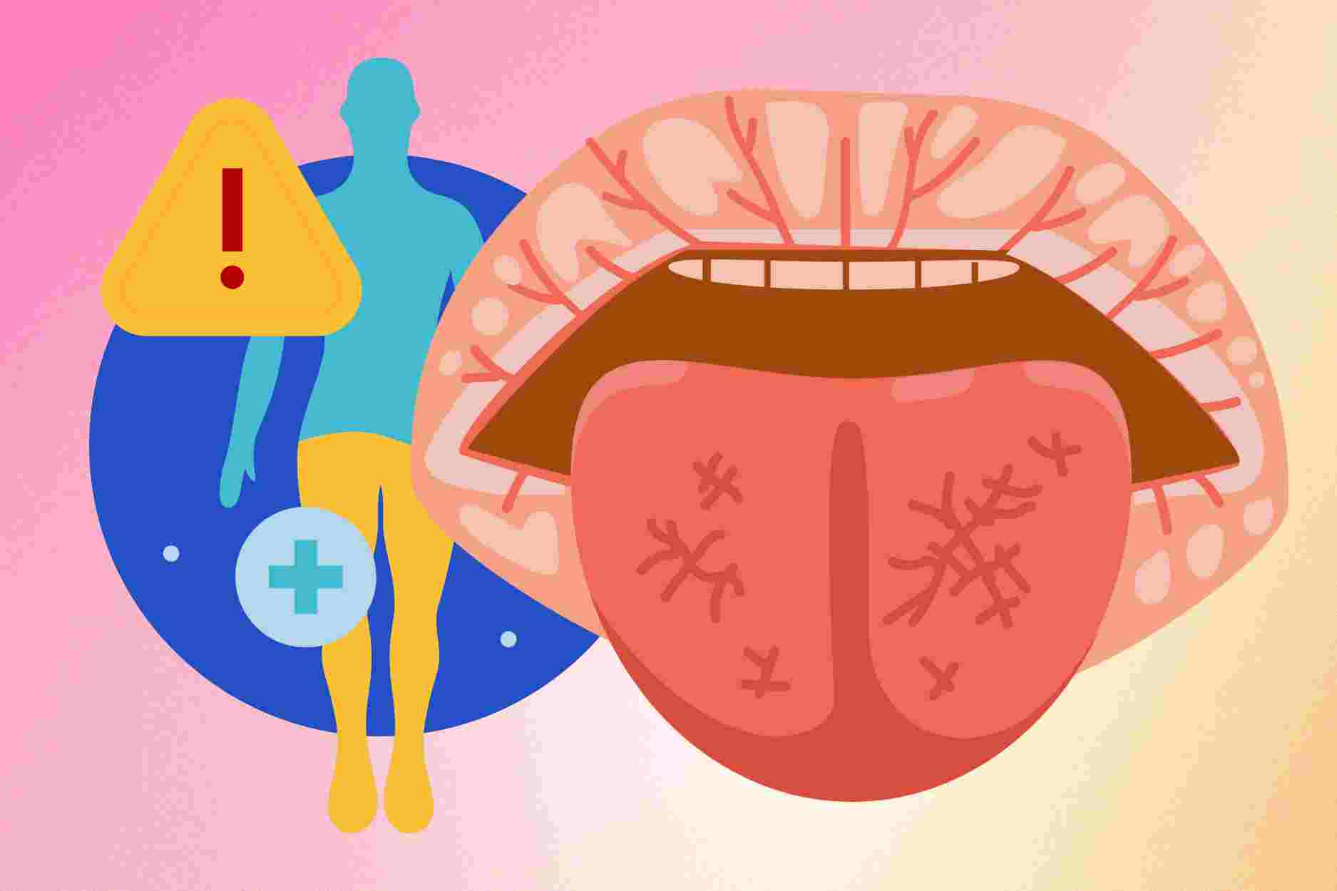 6 signs in the mouth that can warn of substance deficiency