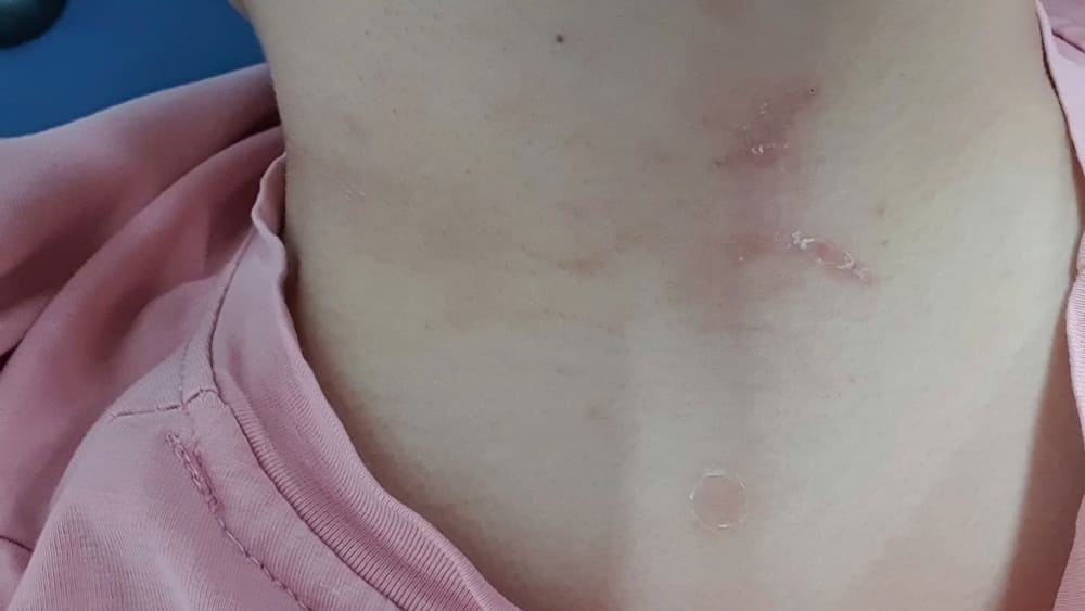 Some basic signs to recognize thrips. Photo: Tuan Dat