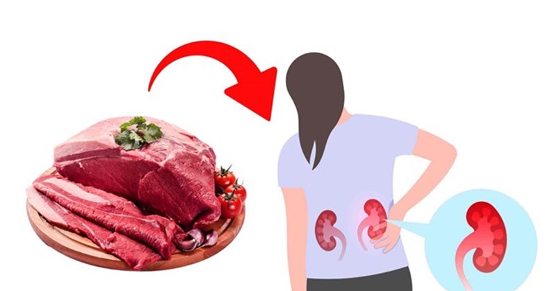 Tiêu thụ thịt quen thuộc có thể làm suy yếu chức năng thận