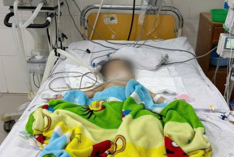 Doctors in Khanh Hoa save a 19-month-old infant with septic shock. Source: General Hospital