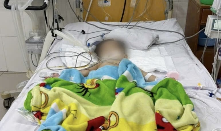 Doctors at Khanh Hoa General Hospital promptly rescued a 19-month-old infant with critical septic shock after drinking milk. Photo: Khanh Hoa General Hospital