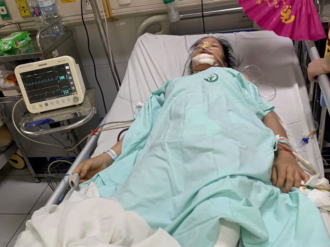 Chị Lường Thị Tỉnh đang được điều trị chuyên sâu tại Bệnh viện Hữu nghị Việt Đức, Hà Nội. Ảnh: Bảo Nguyên 