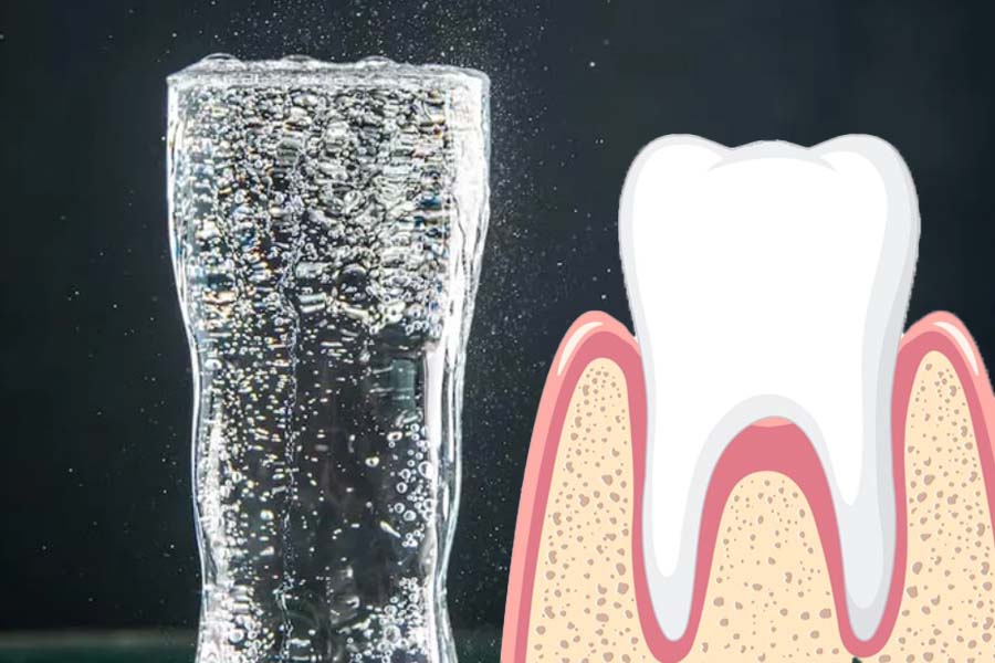 Mineral water with gas and the risk of enamel erosion. Graphics: Thien Nhan
