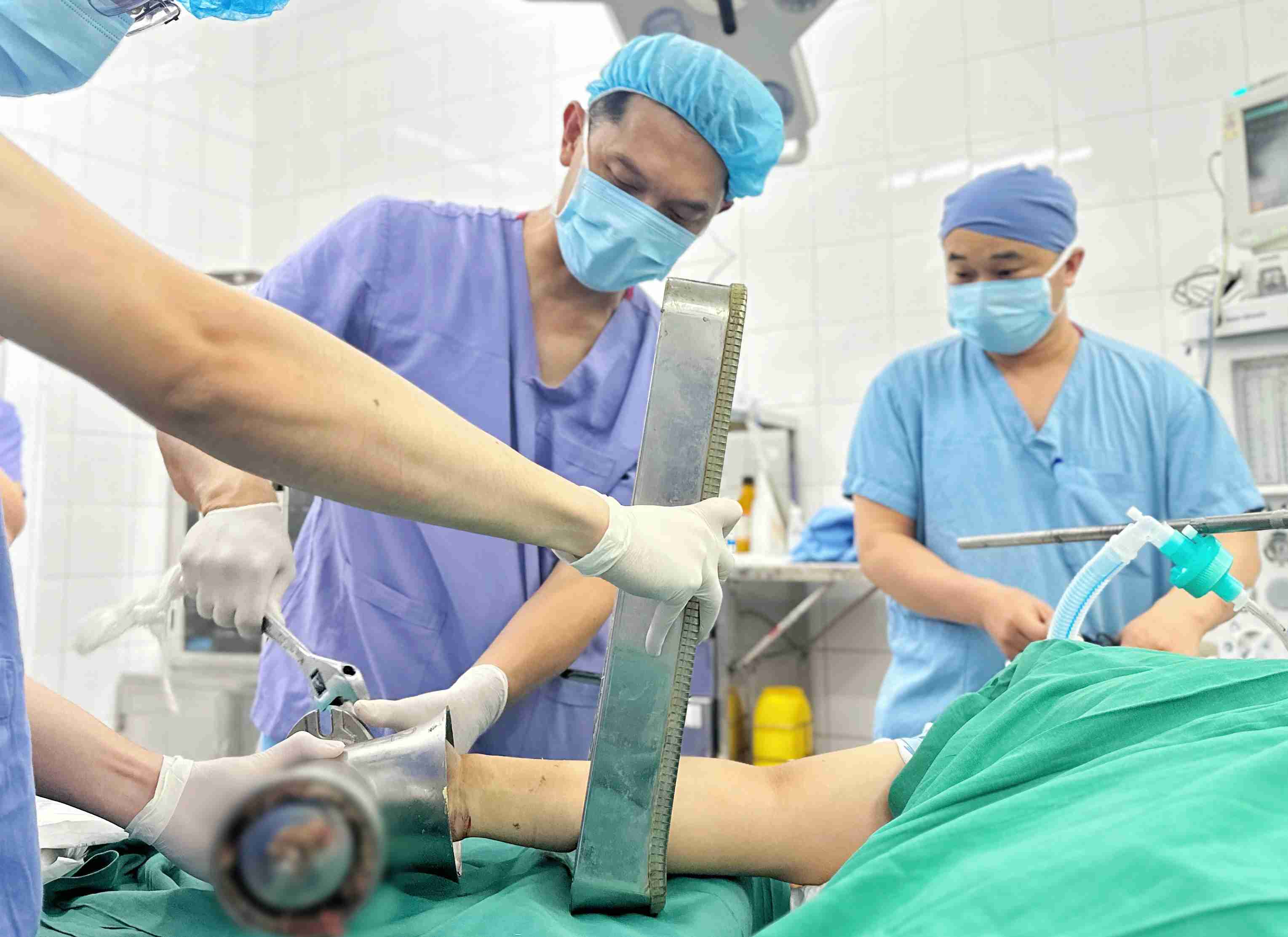 Hand stuck in meat grinder, woman loses forearm. Photo: BVCC