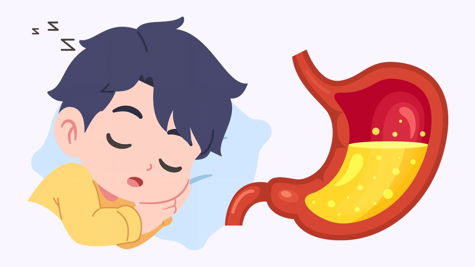 Stomach reflux should sleep in some positions. Graphics: Linh Dan