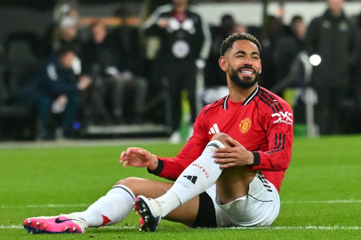 Man United's unbeaten streak has been interrupted. Photo: AFP