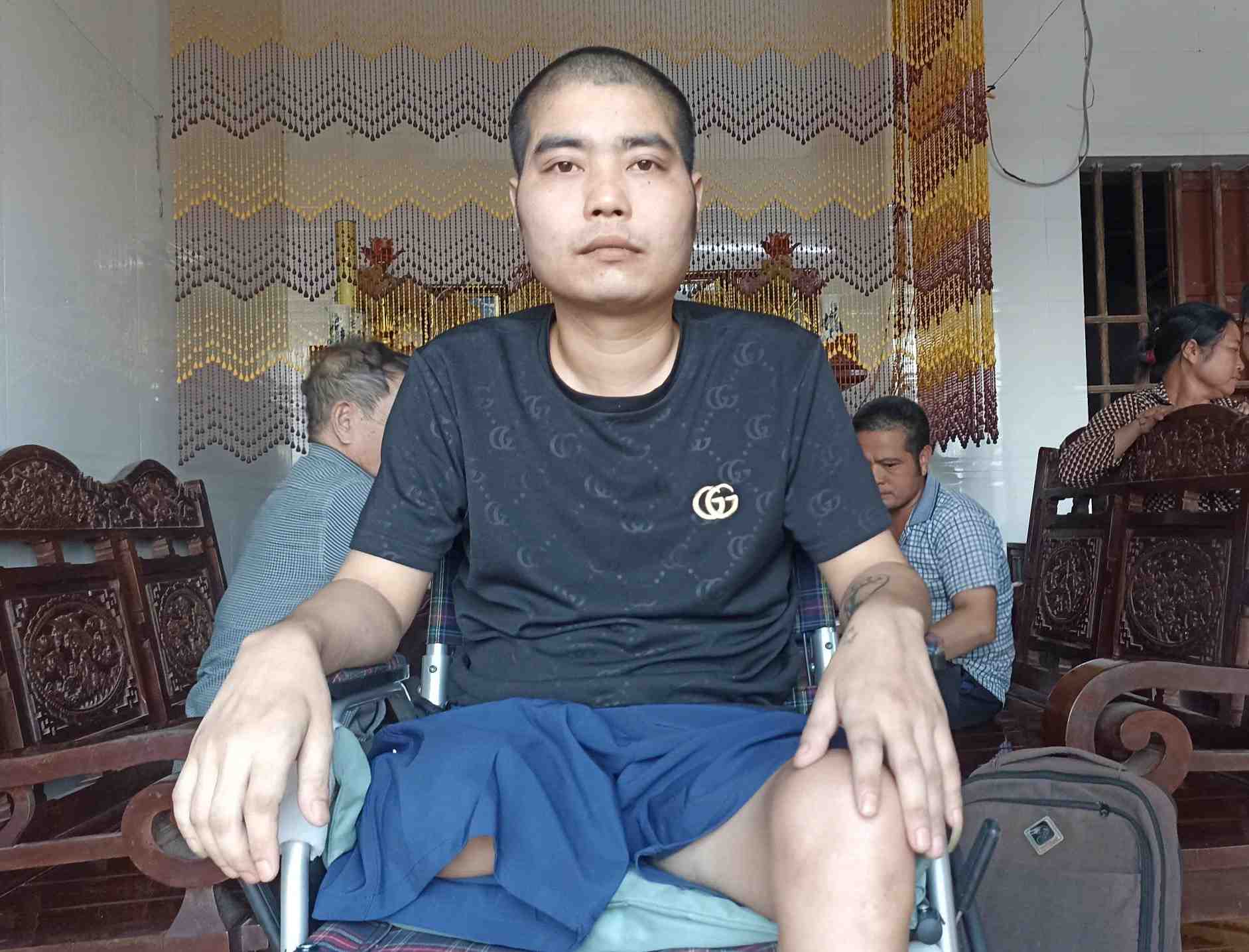 Bone cancer caused Mr. To Dinh Thu to have one leg amputated. Photo: Dieu Anh