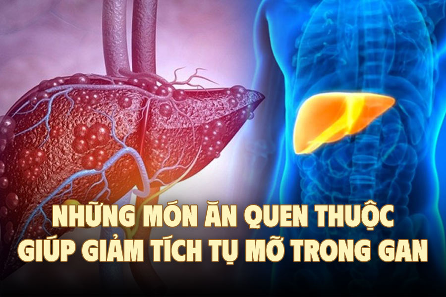 Familiar dishes to help reduce fat accumulation in the liver