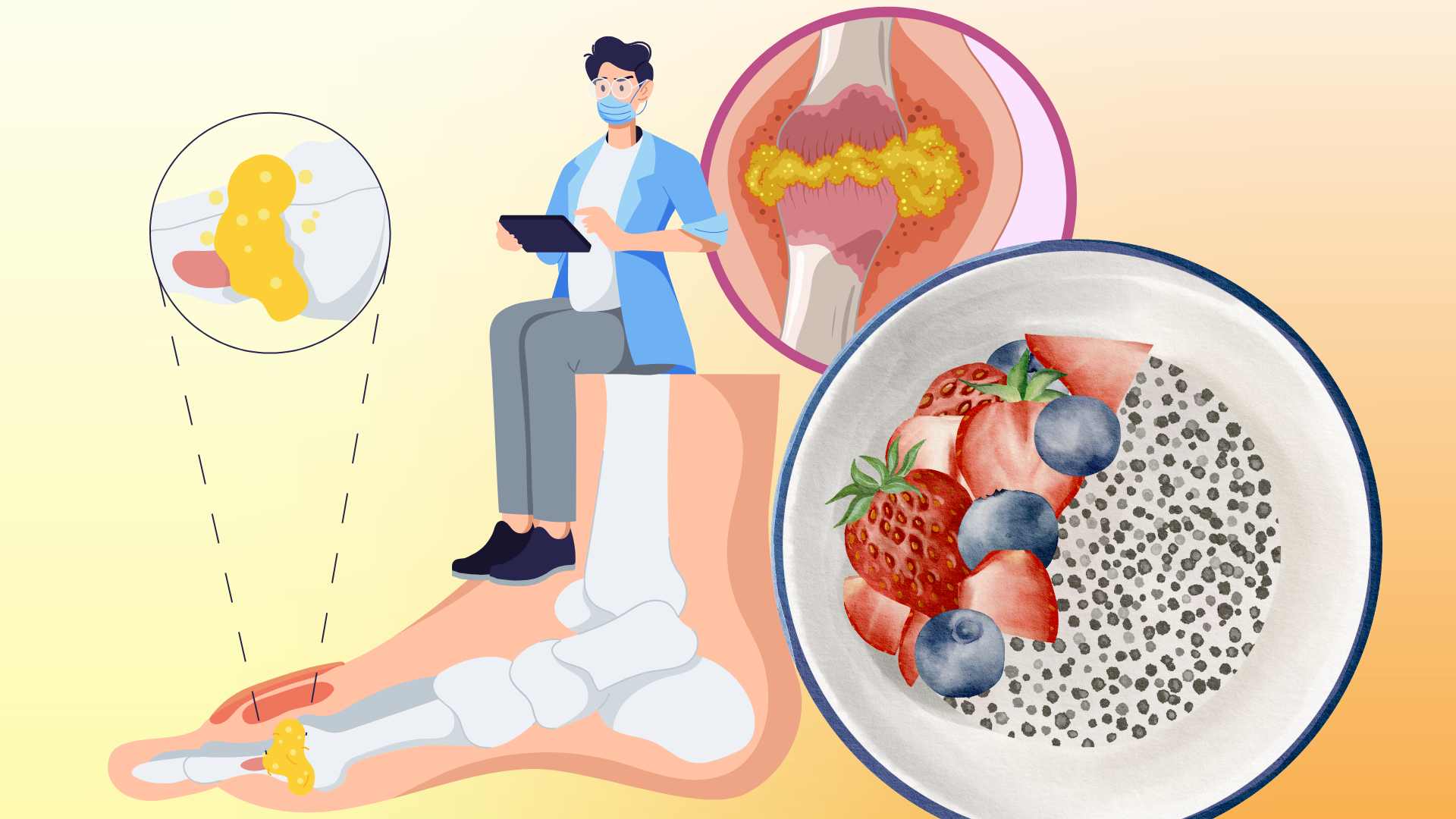 Many types of nuts can help reduce uric acid but need to be eaten properly