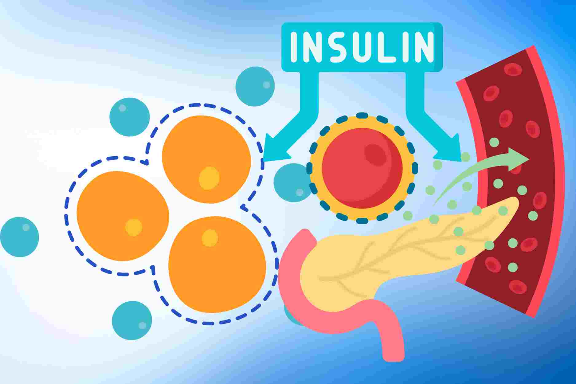 5 main causes of insulin resistance