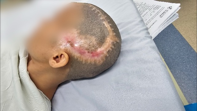 The patient was successfully operated on and recovered well. Photo: BVCC