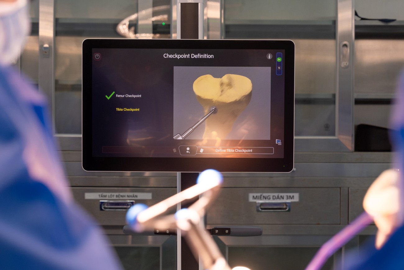 Ảnh 1, ảnh 2: Robot CORI tích hợp trí tuệ nhân tạo AI đóng vai trò như “trợ lý” thông minh giúp bác sĩ thực hiện ca mổ đạt độ chính xác cao.