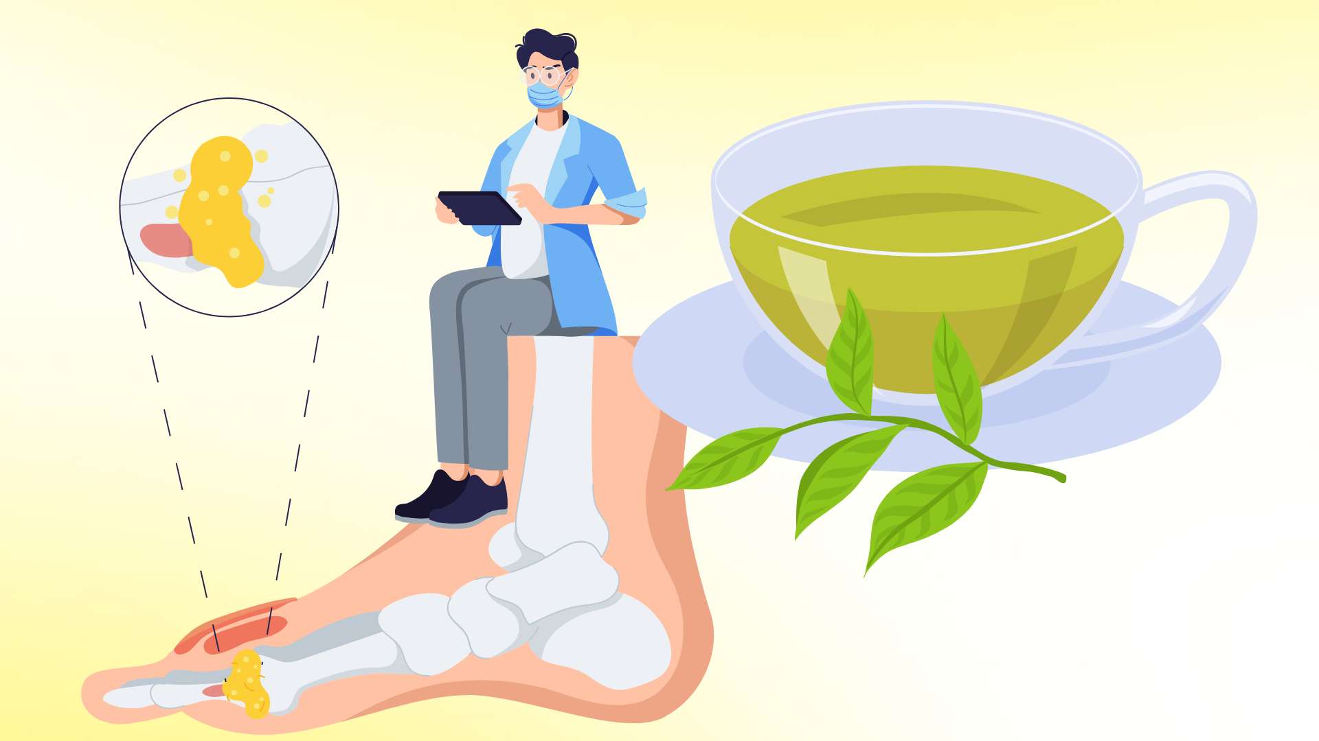 Natural drinks that can help reduce uric acid