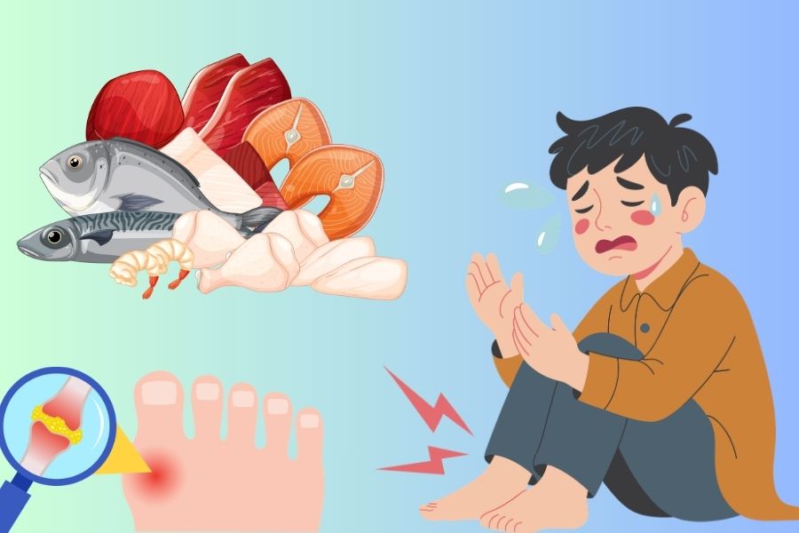 Comparing chicken and beef, which types increase uric acid