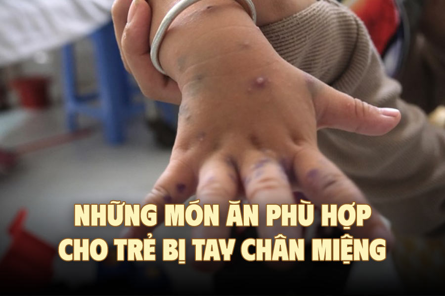 Alimentos adecuados para niños con enfermedad de manos, pies y boca