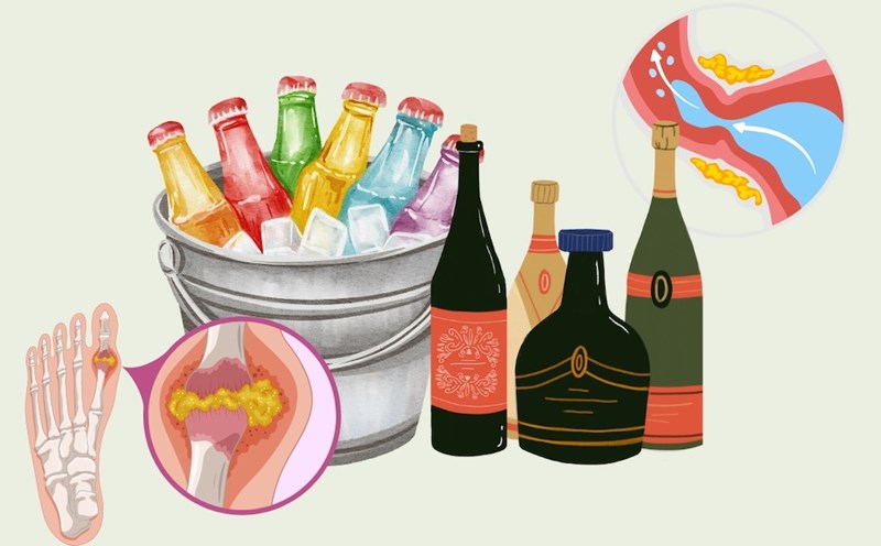 Some drinks can increase the risk of triggering or worsening gout attacks. Photo: Anh Phong