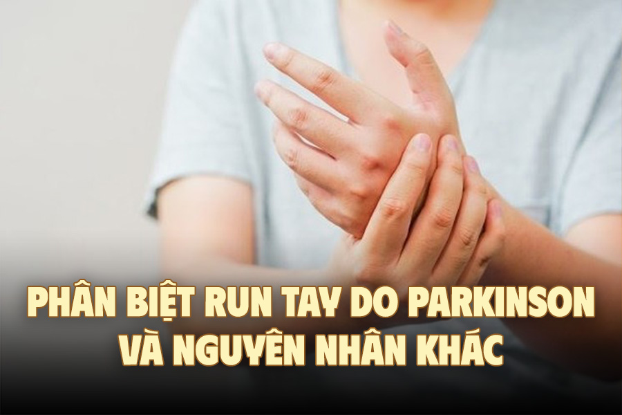 Differentiating Parkinson's hand tremors and other causes