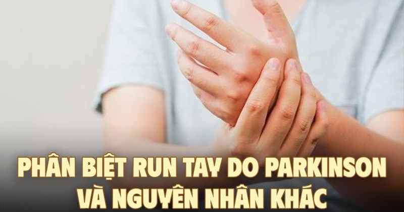 Phân biệt run tay do Parkinson và các nguyên nhân khác
