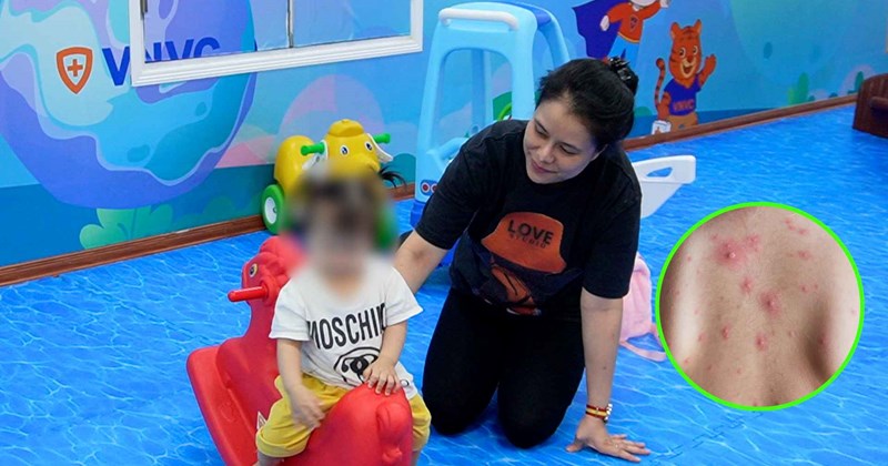 Mùa thủy đậu: Nhiều gia đình cho con tiêm phòng sớm