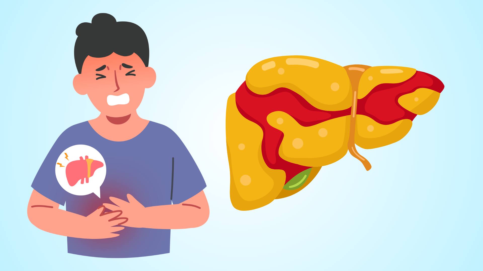 In addition to alcohol and beer, these 3 familiar drinks can also cause fatty liver.