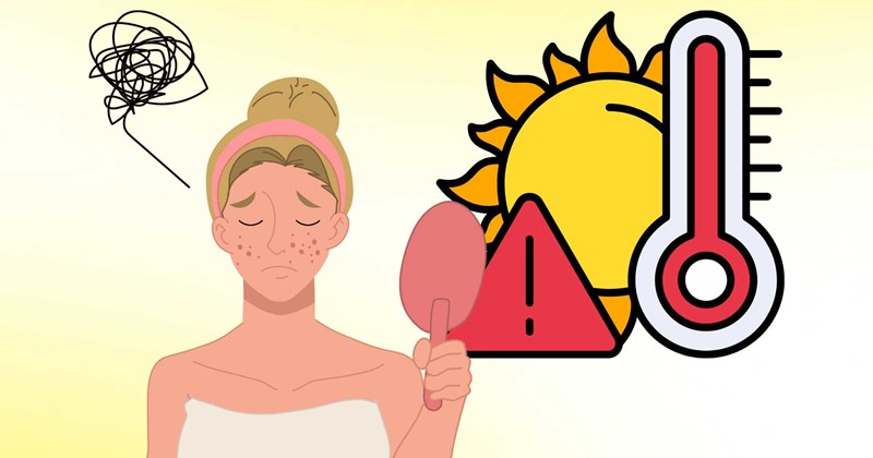 Nắng nóng dễ gây mụn, áp dụng ngay các biện pháp bảo vệ da