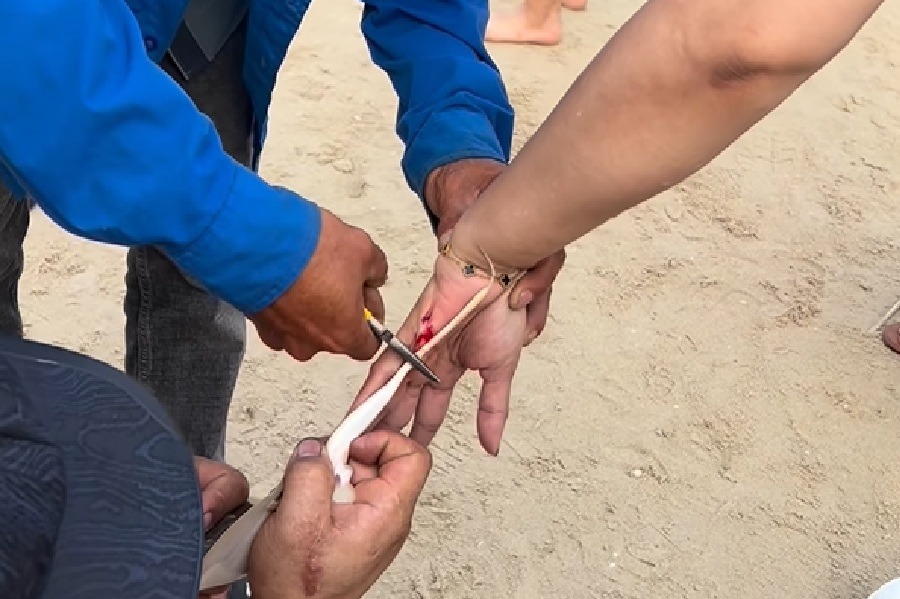 Un touriste attaqué par une raie à Vũng Tàu le 12 avril. Photo: NDCC