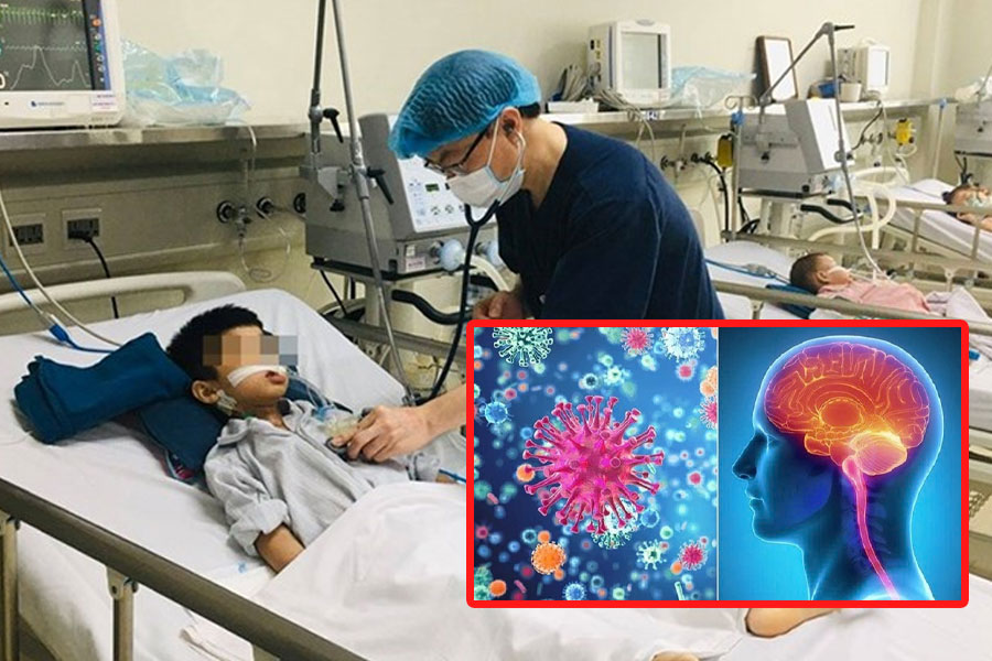 Meningococcal cases increase, doctors warn of dangerous complications