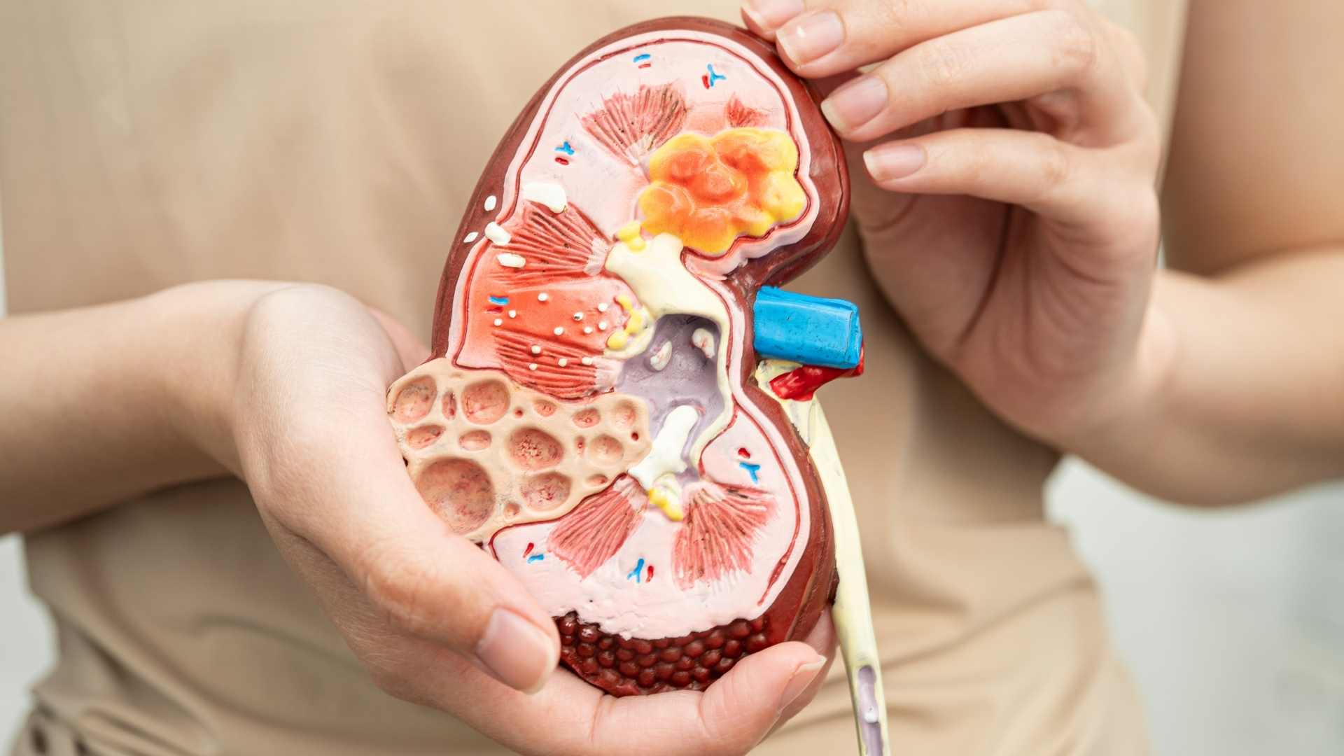 Understand correctly uric acid and creatinine to protect kidneys early