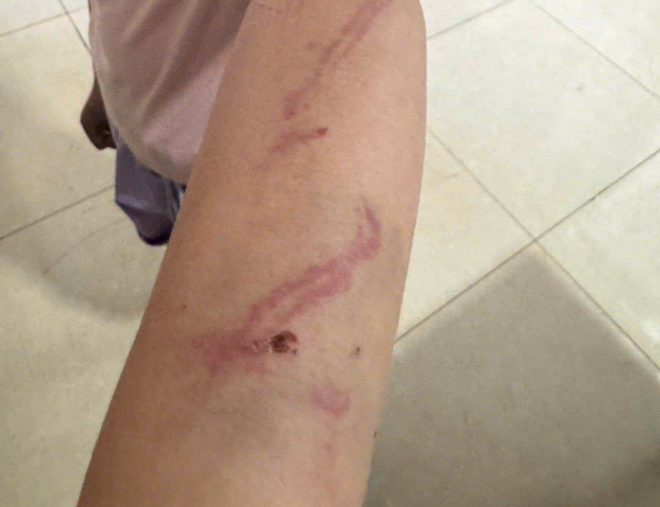 Công an phường Buôn Ma Thuột (tỉnh Đắk Lắk) đã vào cuộc, làm rõ vụ bé gái 9 tuổi nghi bị bạo hành. Ảnh: Bảo Trung
