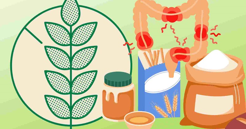 Loại bỏ gluten có cải thiện triệu chứng IBS?