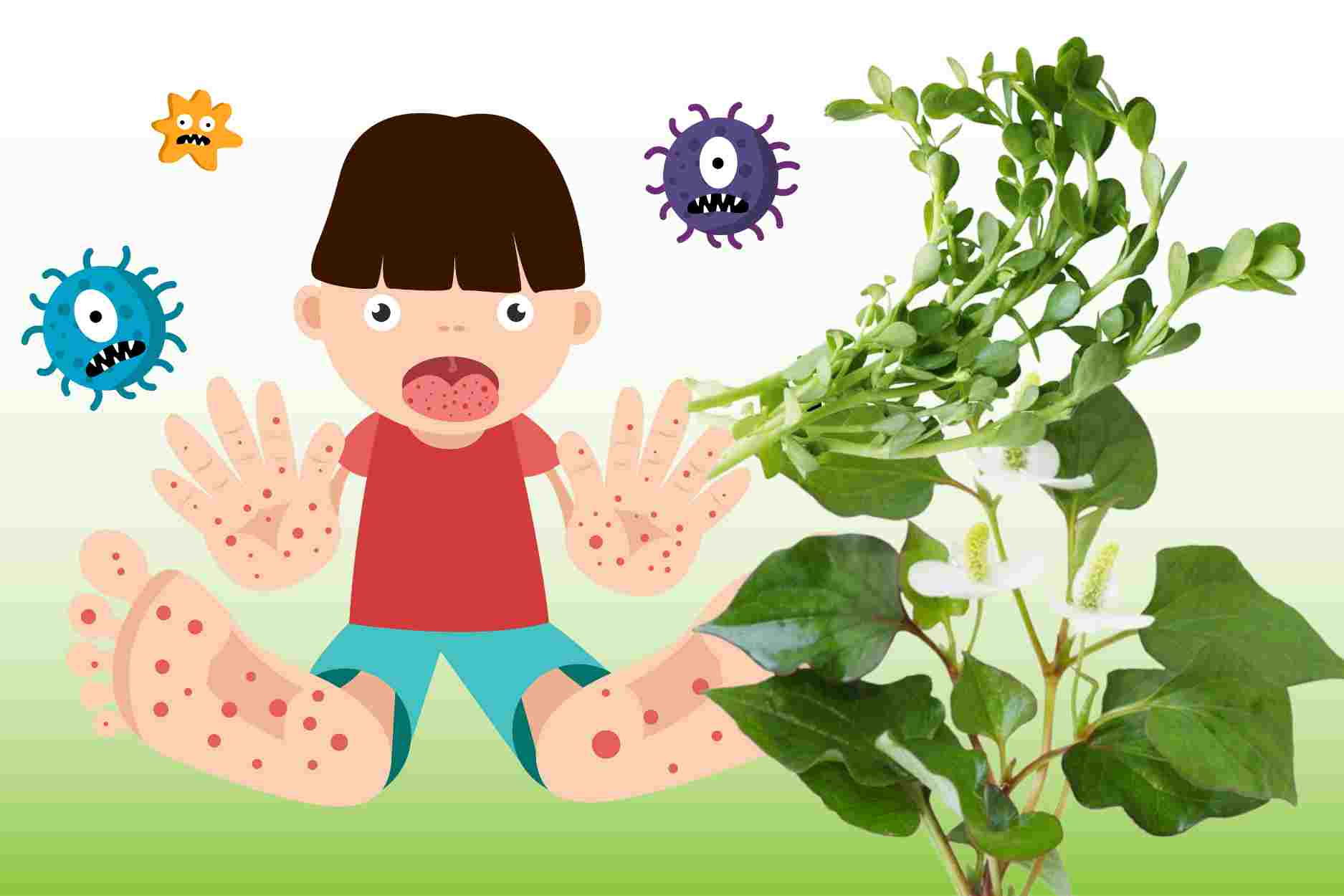 3 types of folk leaves to help cool down and reduce symptoms of hand, foot and mouth disease in children