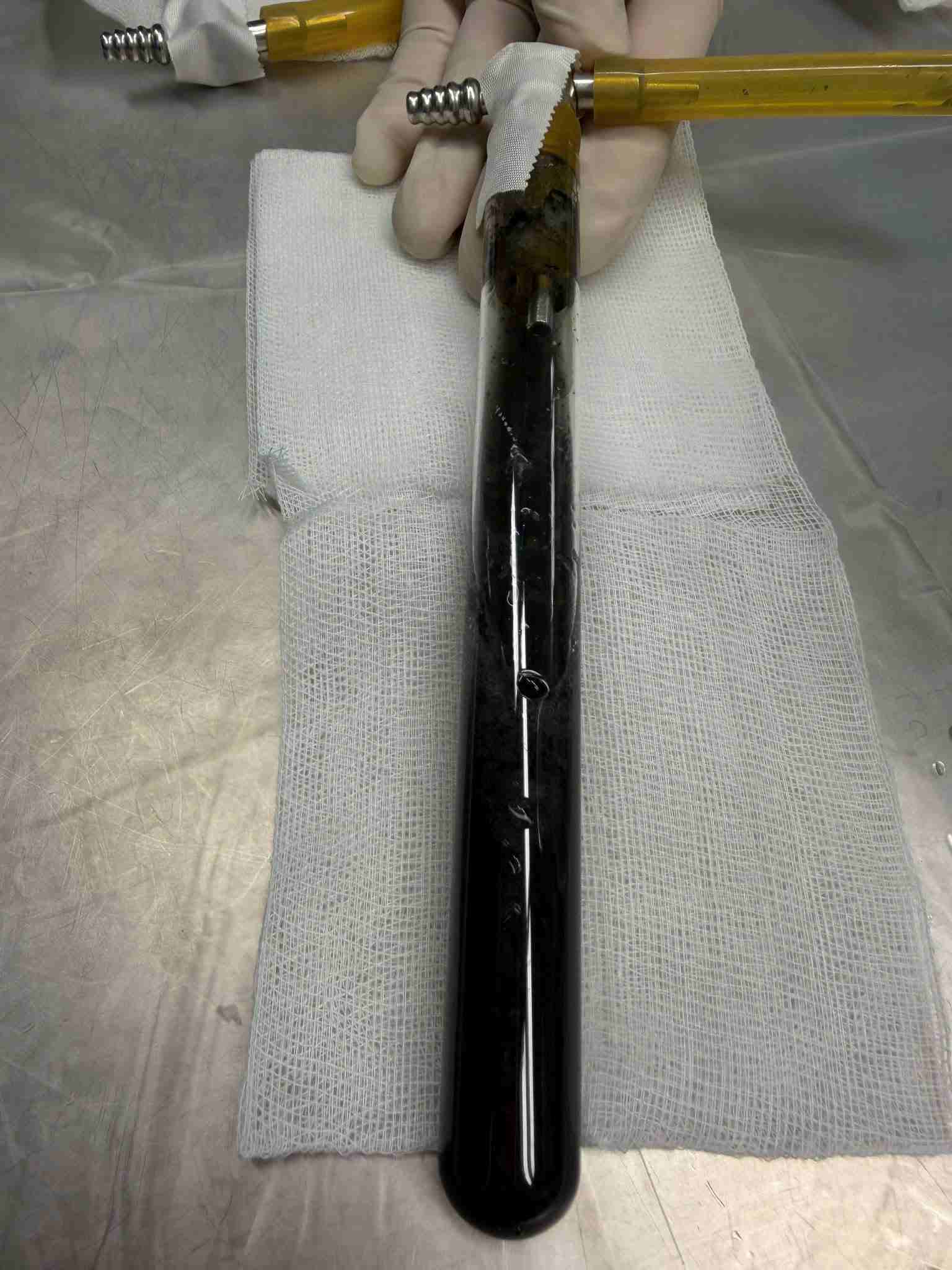 Nước rửa phổi của nạn nhân đen kịt. Ảnh: BVCC