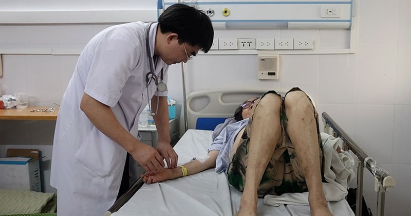 Bác sĩ cảnh báo loãng xương không chỉ ở người cao tuổi
