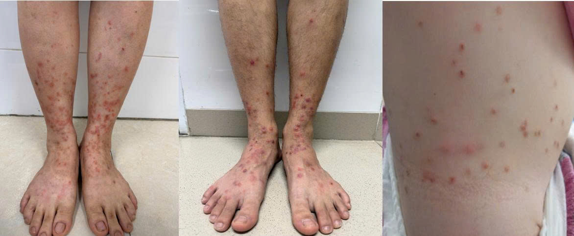 Notes when treating flea-borne dermatitis. Photo: BVCC