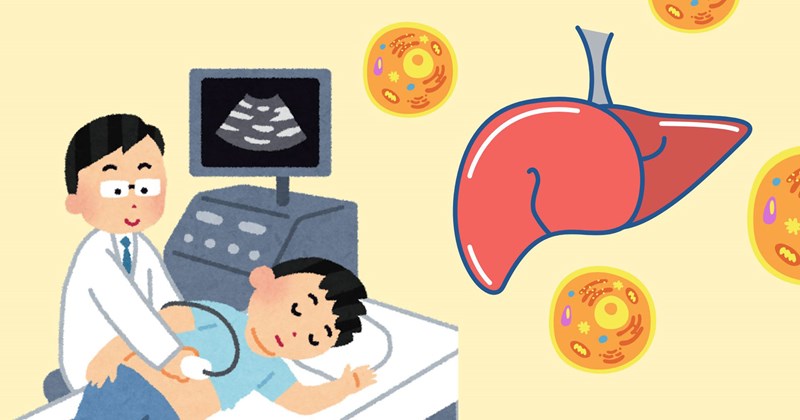 Gan nhiễm mỡ độ 1 và các dấu hiệu ban đầu