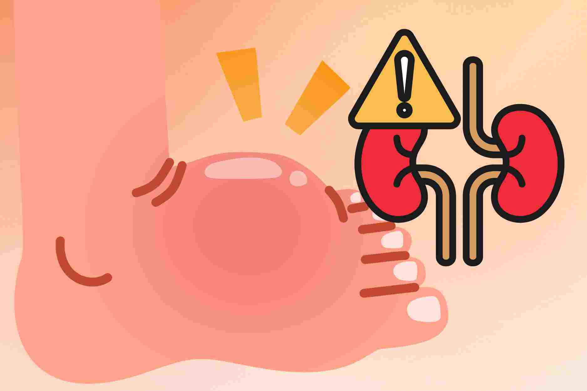 2 abnormal signs in the legs early warning of kidney failure