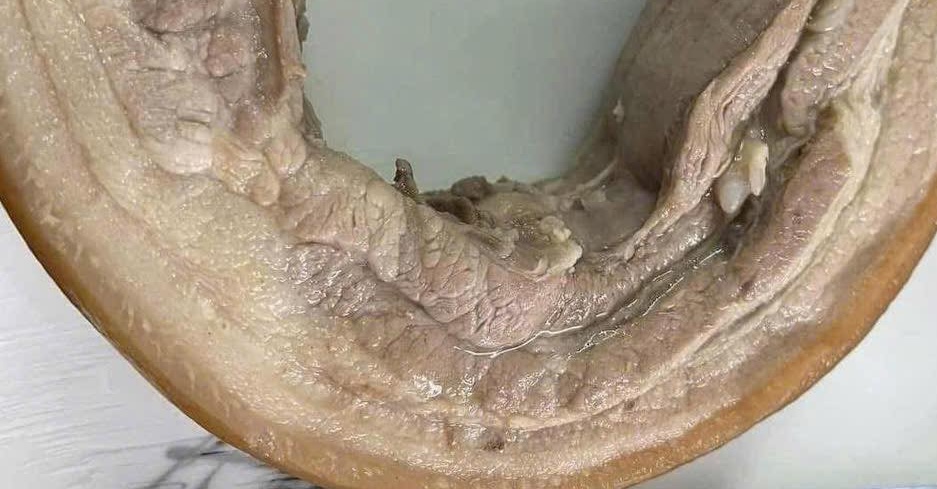 The weight loss process will not be affected if you eat boiled pork belly with a reasonable portion size. Photo: Kieu Vu