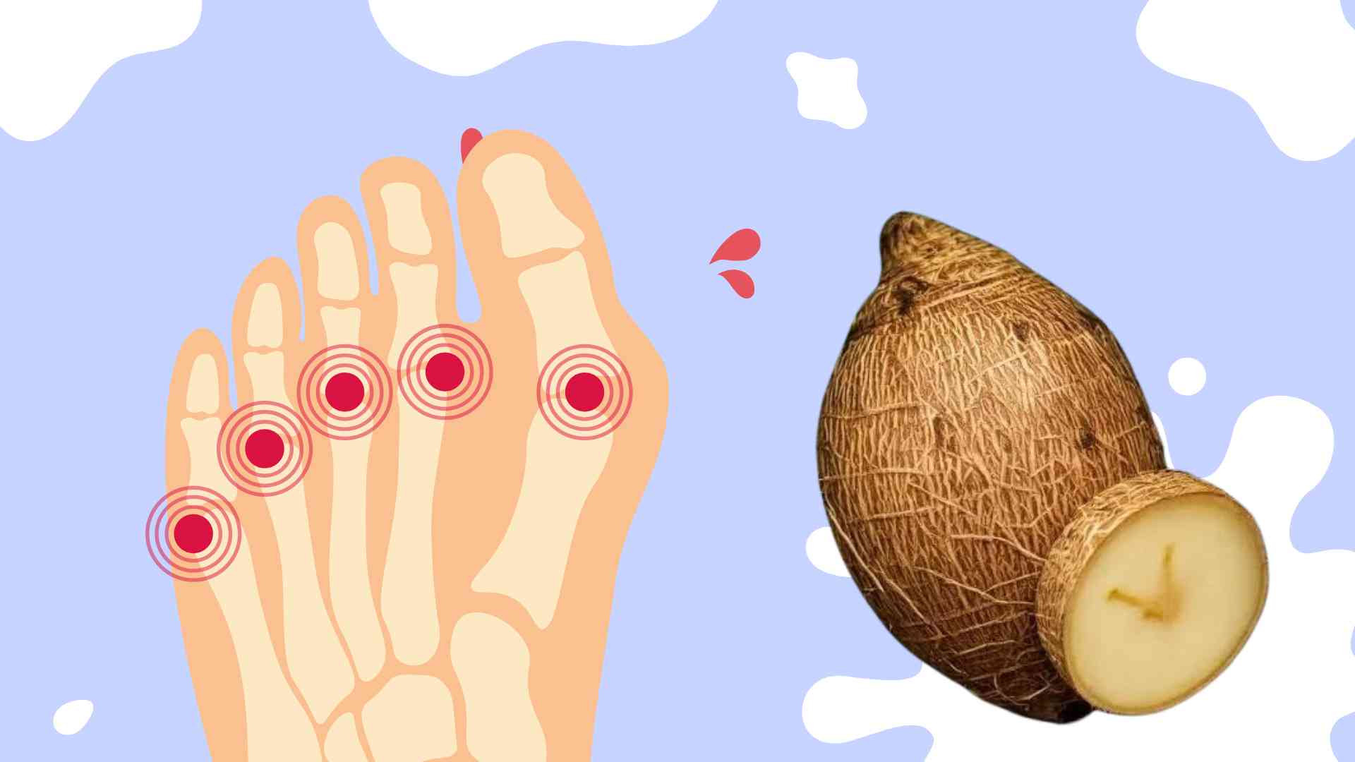 Sweet potatoes contain glucomannan – soluble fiber that supports uric acid excretion. Graphic photo: Huong Son