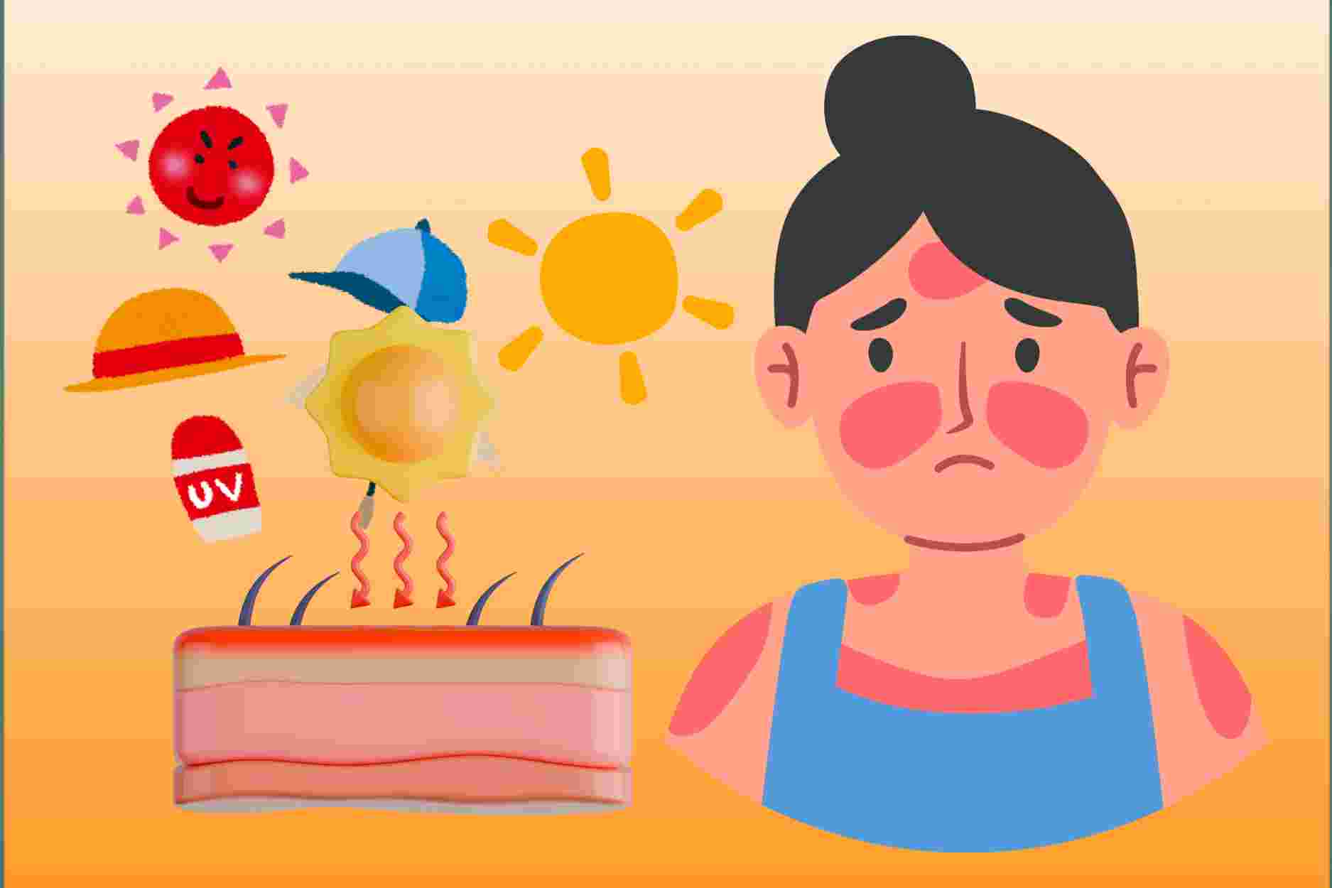 Natural solutions to help reduce summer tanning