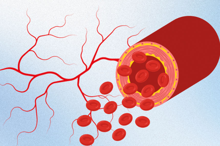 동맥에 해로운 7가지 아침 습관