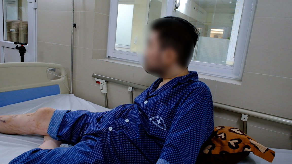 Nam bệnh nhân 32 tuổi bị suy tuyến thượng thận do tự ý dùng thuốc điều trị gout suốt 10 năm. Ảnh: Mỹ Ly