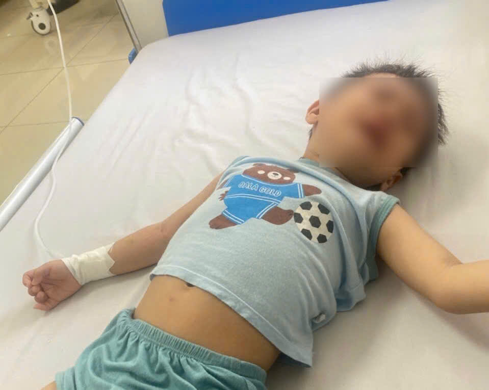 Hành trình chữa bệnh của bé Khang chưa dừng lại, những cơn đau khiến bé thường xuyên quấy khóc, có những ngày không thể ăn uống... Ảnh: Gia đình cung cấp