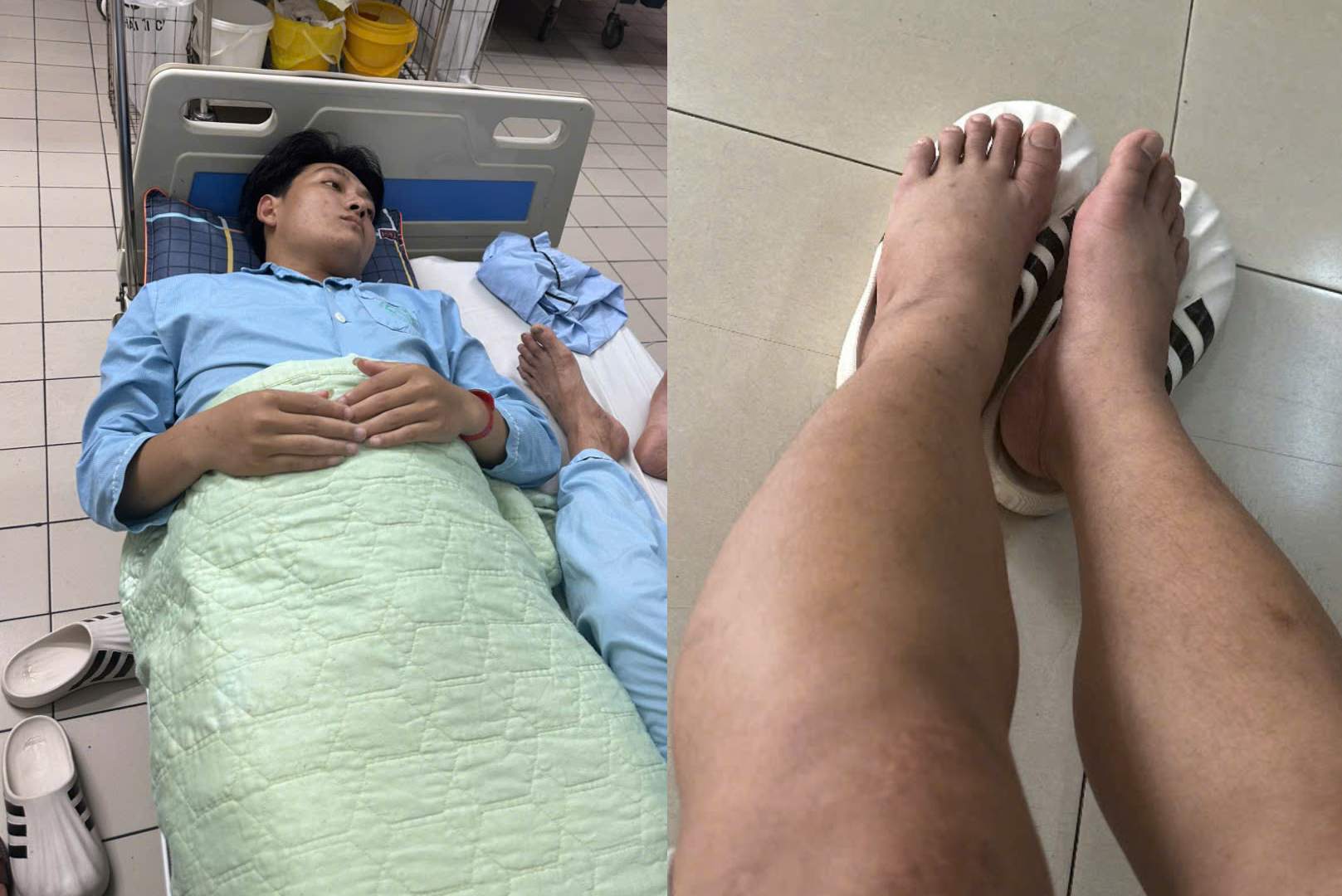 Em Hặc hiện đang điều trị tích cực tại Bệnh viện Bạch Mai. Ảnh: Nhân vật cung cấp