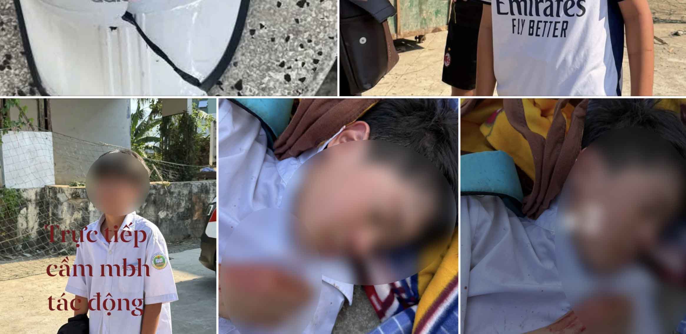 Police and the school have coordinated to investigate the case of a male student scuffling in Tay Nha Trang ward. Photo: Vinh Thanh