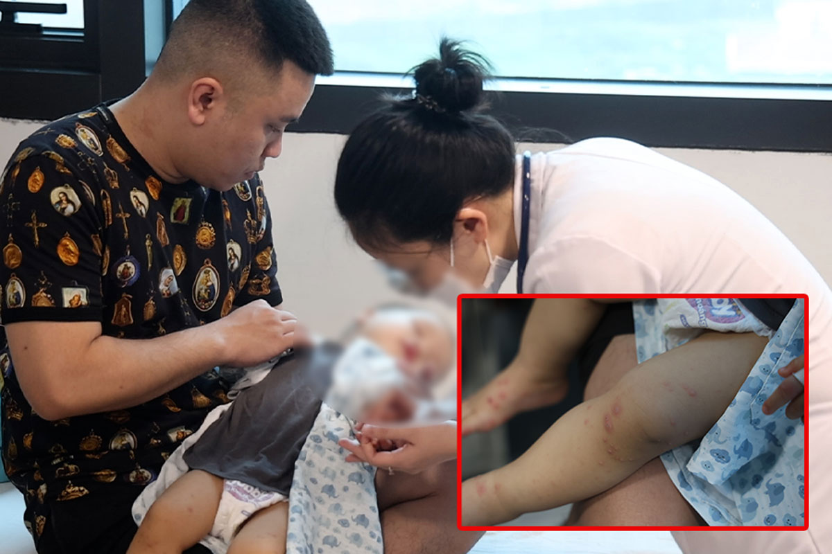 Hand, foot and mouth disease increases, EV71 reappears, increasing the risk of seriousness