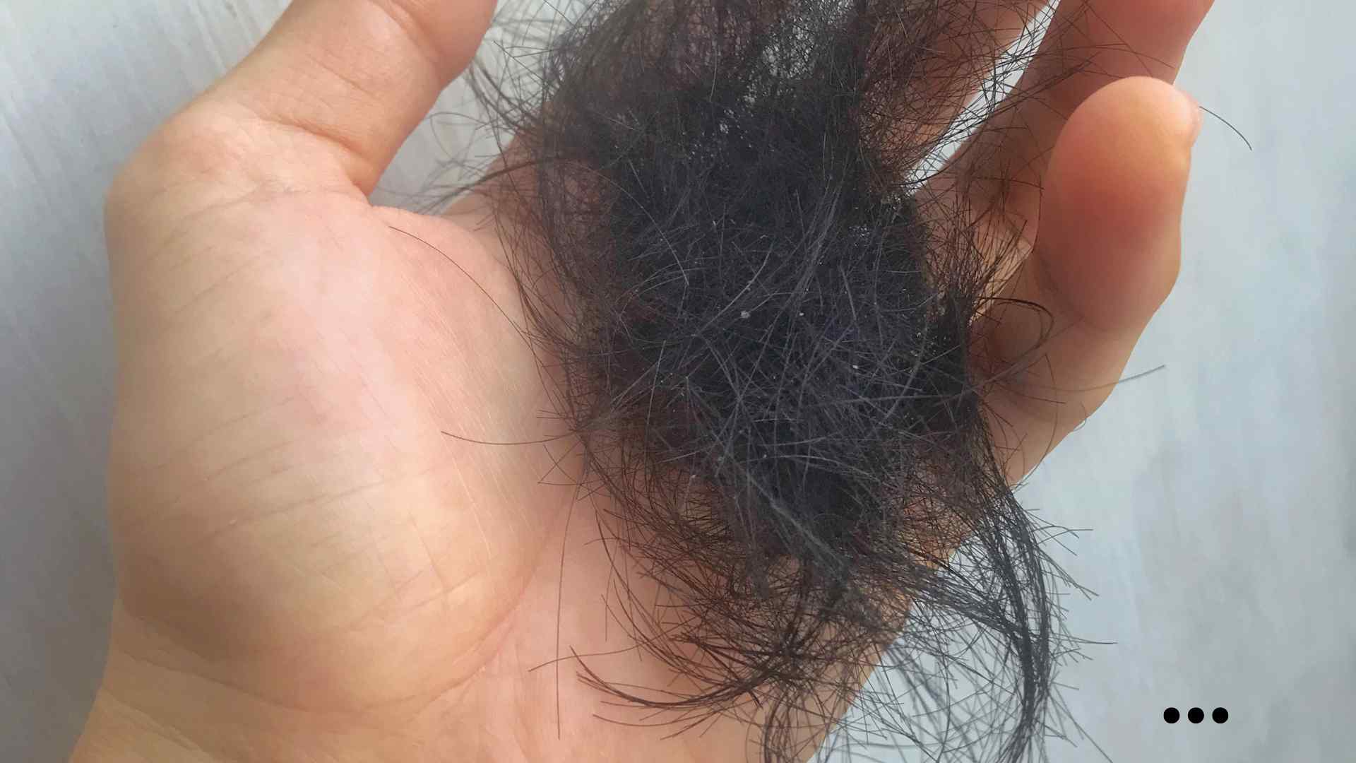 Frequent hair loss may be due to a habit of washing your hair too often or incorrectly. Photo: Nguyen Ly