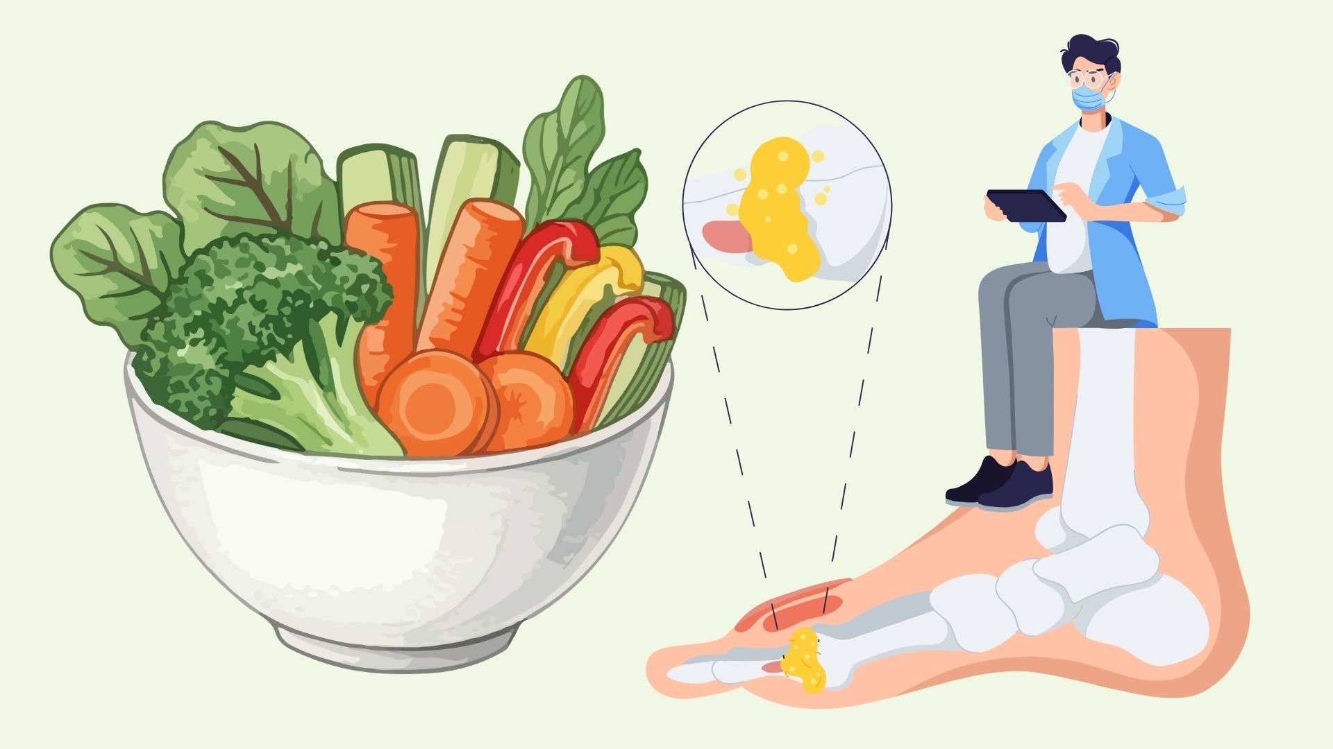 Not taking medicine still controls uric acid thanks to some habits. Graphics: Linh Dan
